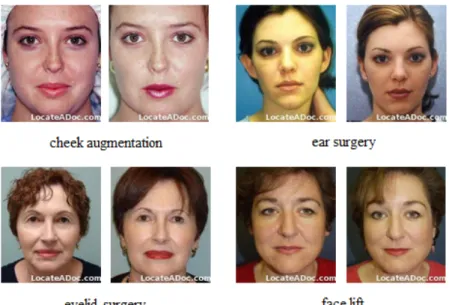 Figure 2.8: Some pre-surgery (left) and post-surgery (right) pairs on the plastic surgery database.