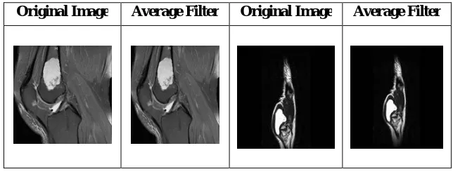 Table 2.Comparisions of various segmentation techniques  