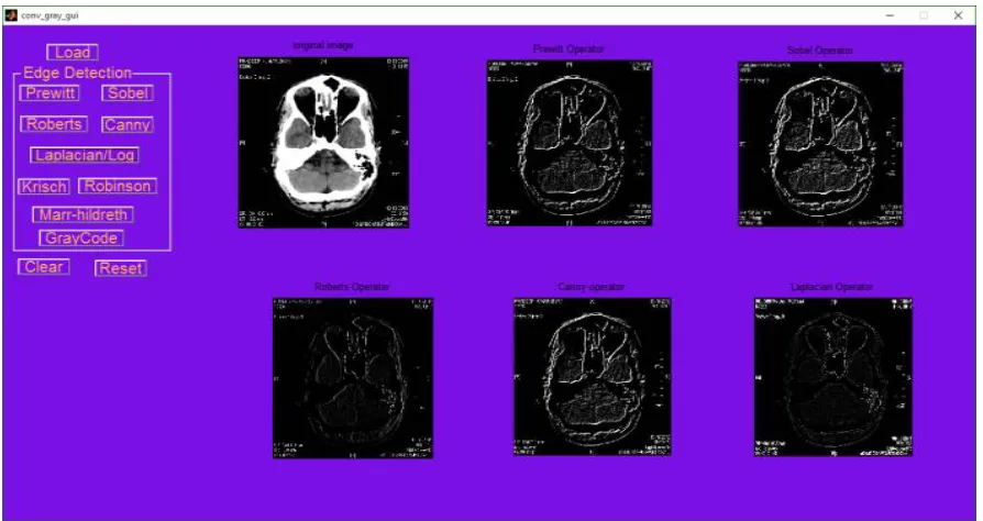 Fig. 3: Result of edge detection techniques. 