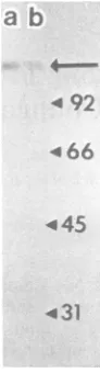 FIG. 2.heat-denatured,an average Typical results from a filter binding assay indicating saturation (maximum retention) of sonicated, 'H-labeled HSV-1 DNA with ICP8 at a 10:1 protein-to-DNA weight ratio