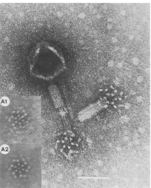 FIG. 7.originalshowedstructure Wild-type SPOl particles, showing basal structures associated with contracted sheath