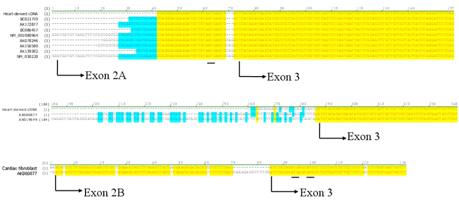 FIGURE 4- Alignment of HeLa-derived human Sp2 cDNA acquired using 5'RACE with GenBank-drived human Sp2 cDNAs