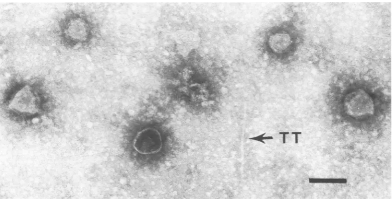 FIG. 5.of both Micrograph of P1 aml80 defective lysate showing a normal length tail tube (TT) as well as full heads PlB and PlS