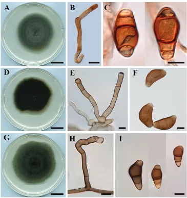 Figure 5. Curvularia reesii (BRIP 4358): A colony on PDA B conidiophore C conidia. Curvularia sporo-bolicola (BRIP 23040b) D colony on PDA E conidiophores F conidia