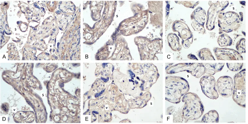 Figure 4. TNFAIP8 expression in placentas of the three groups (immunohistochemistry, 400 ×)
