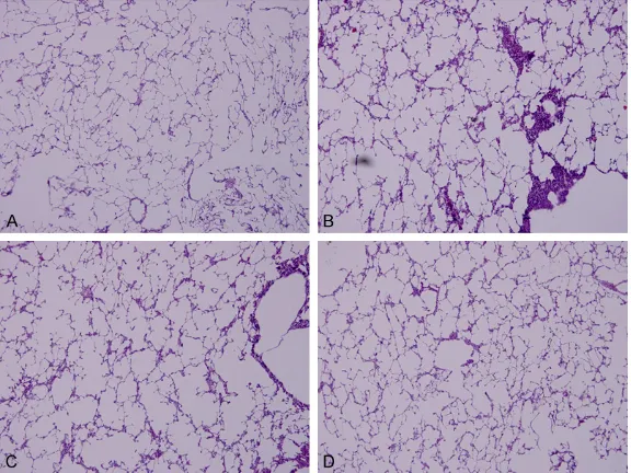 Figure 2. Morphological changes of lung tissues in PQ poisoning model and PQ+NaSAL group by HE staining
