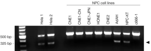 FIG 4 HeLa cell-speciﬁc L1 retrotransposon marker is present in a group ofNPC cell lines