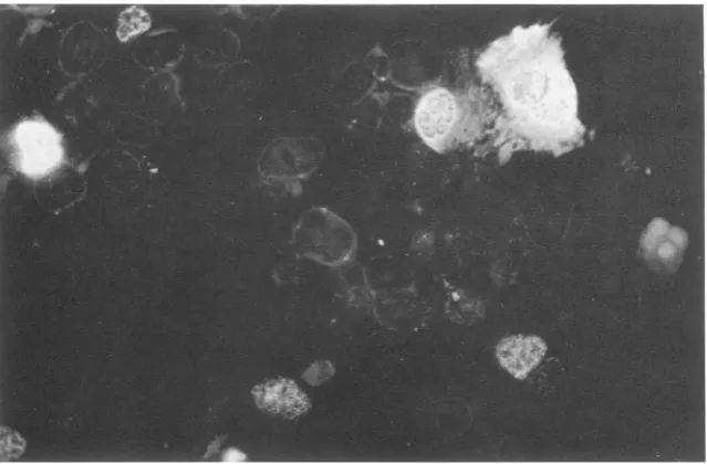 FIG. 5. Indirect immunofluorescent staining of recombinant-virus-infected cells for T antigen g.