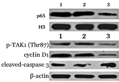 Figure 3. Cell apoptosis in the different groups. *P < 0.05, compared to the blank group; #P < 0.05, compared to the control group.