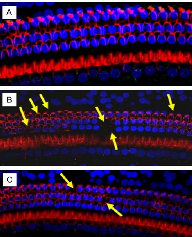 Figure 4. Nucleus and cilia staining of cochlear organ of Corti. A. The normal control group, the nucleus of inner and outer hair cells in the basal turn organ of Corti were arranged neatly, with the epidermal plate stained clearly; B