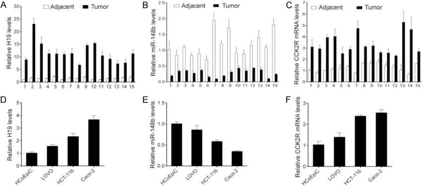 Figure 1. Expression of H19, miR-148b and CCK2R in CRC cancer tissues and CRC cell lines