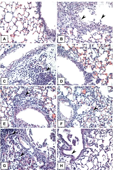 FIG 5 Histopathologic changes in tissues from inﬂuenza virus-infected mice. Photomicrographs of lung tissue sections stained with hematoxylin and eosin(magniﬁcation,heads) on day 1 in a mouse infected with H7N9 (A/Anhui/1/2013)