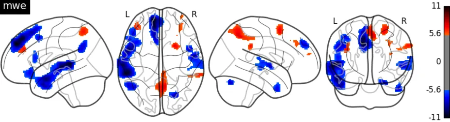 Figure 4: T-score map for the MWE status regressor. Red represents the positive score while blue represents the negative score.