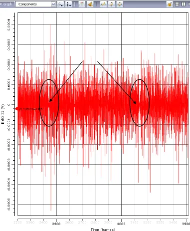 Figure 9: Sample profile of right anterior deltoid activity. The profile depicts the 22s-35s time interval and encompasses two perturbations, indicated by the arrows and circles  