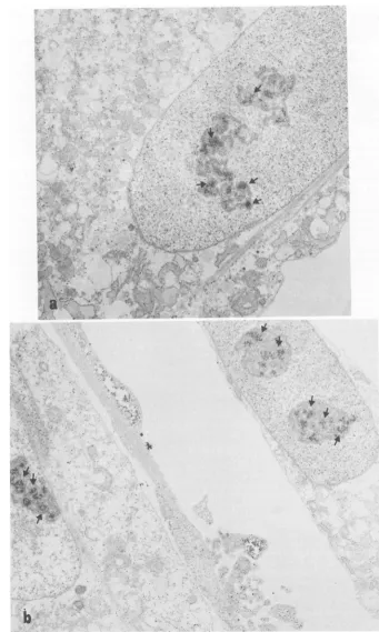 FIG. 1.inantibodyMagnification,addition,indicate 2% Electron micrographs of cells stained with absorbed immune serum