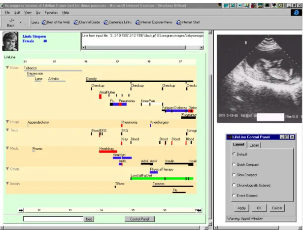 Figure 2.17: LifeLine multiple-view interface demonstrates the patient’s medical records on the timeline in several facets with the facilities to zoom and filter
