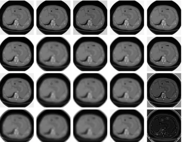 Fig. 9. The amplitude responses of circular Gabor bank filtered spectral CT image