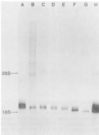 FIG. Sizersisolated 2. analysis of precursoi from total cellular RNA. T(otal