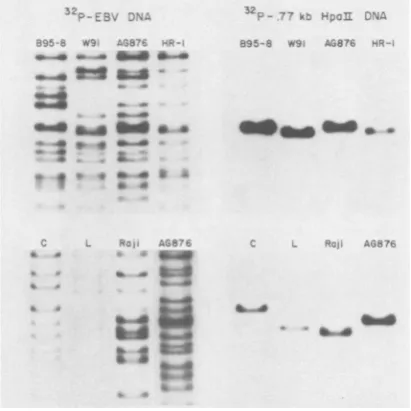 FIG. 3.digestedgels,filters72°C)panelstorehybridizationedAG876,differentEBV the cells Conservation of IR3 sequences in DNAs of EBV strains