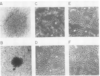 FIG. 6.toderivedNormal 20 Biological activity of cloned FSV DNA. A focus induced in NIH-3T3 cells (A) and a colony formed 17 days after transfection with pFL-5 DNA (B)