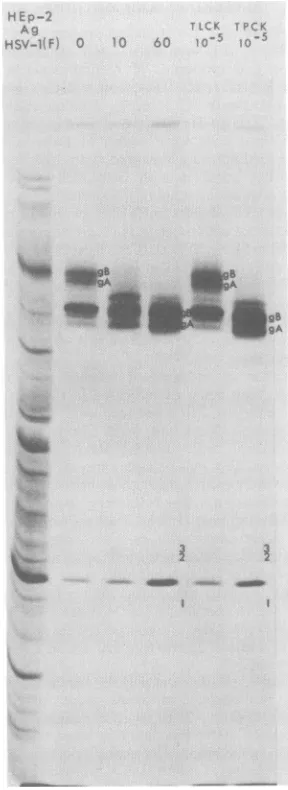 FIG. 1.icallyimmunoprecipitatedHEp-2andatg(A+B)P-C,infected-cellslowly 6 Autoradiographic images of electrophoret- separated [35S]methionine-labeled polypeptides with monoclonal antibody H233