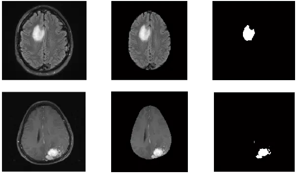 Fig. 5.1: The Proposed Methodology for Brain MRI Segmentation  