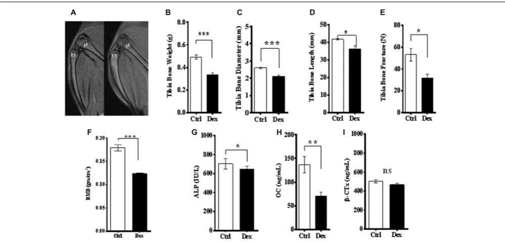 FIGURE 2 | Effects of Dex treatment on bone tissues. A representative MRI of knee and lateral femur and tibia in Ctrl (left), and Dex (right) shows a bone deformity inmineral density measured byreduced in Dex group (treated animals (Dex treated animals com