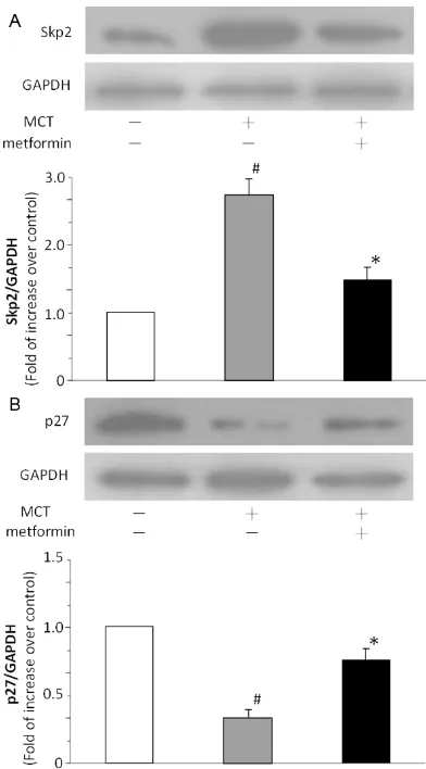 Figure 3. Effects of MCT and metformin on the phos-phorylation of AMPK in rat lung tissues