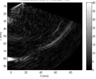 Figure 6. TFM in an Isotropic Stainless Steel weld with three 2mm SDH defects present  