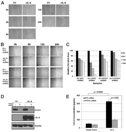 FIG 5 HYOU1 facilitates vIL-6-induced migration of endothelial cells. (A) hTERT-HUVEC stably expressing an empty vector (EV) or FLAG-tagged vIL-6 weresample concentrations, with aserum starved overnight and scratched with a P10 pipette