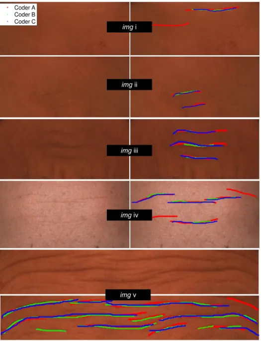 Fig. 7. Samples of Manual Annotation. Each row shows an original image (left) and annotated image of three coders (right)