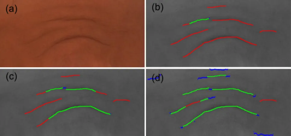 Fig. 8. Automatic detection of coarse wrinkles. (a) Original image. (b), (c) and (d) are the wrinkle detection by CLM, FRF and HHF, respectively