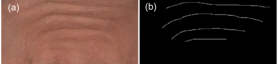 Fig. 1. Result of manual annotation. (a) and (b) present the original forehead image and the corresponding mask of manual annotation, respectively.