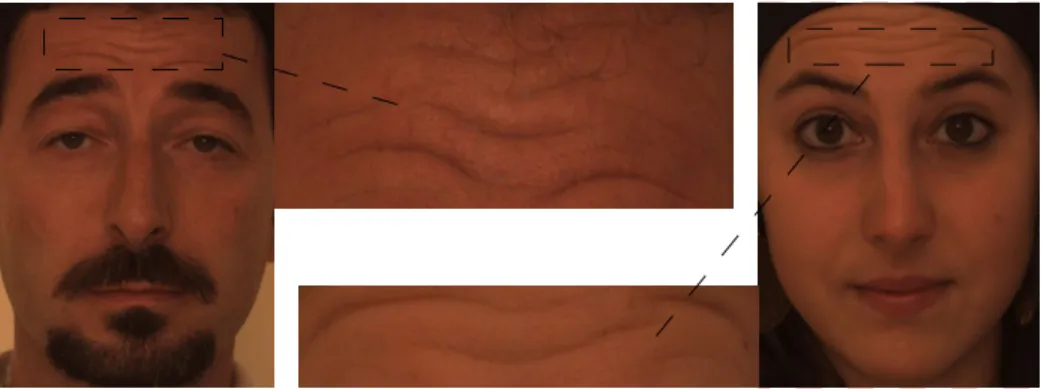 Fig. 4. Sample of forehead image. The dash lines show the portion of forehead image cropped from the original facial image