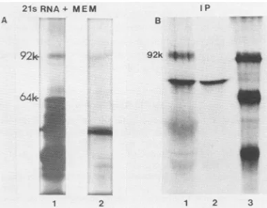 FIG. 4.dog(laneweighttrypsindogalcreatic(B)mentwasproductreticulocytemicrosomalwasKatz21Smicrosomal1, membranes total Translationandimmunoprecipitationof viral mRNA in the presence of dog pancreas membranes