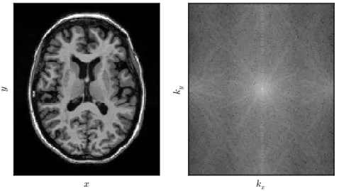 Figure 1.1.3: A brain MRI image (left) and its k-space representation (right).