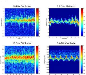 Fig. 4. Measured spectrograms of a single person walking with a limp.