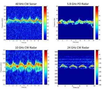 Fig. 7. Measured spectrograms of a single person walking with a walker.