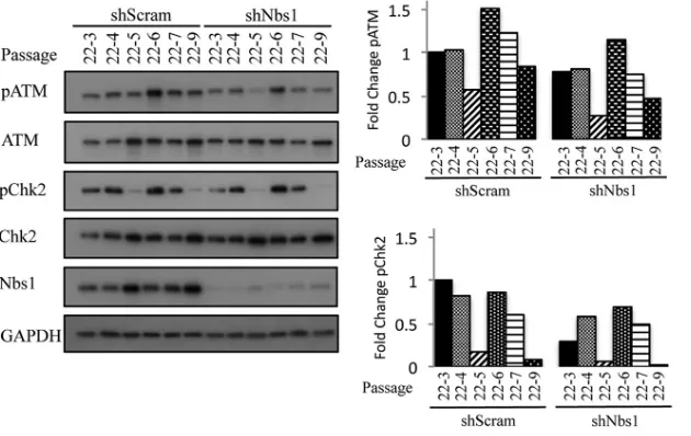 FIG 10 Phosphorylated ATM and Chk2 levels are decreased variably in response to Nbs1 knockdown