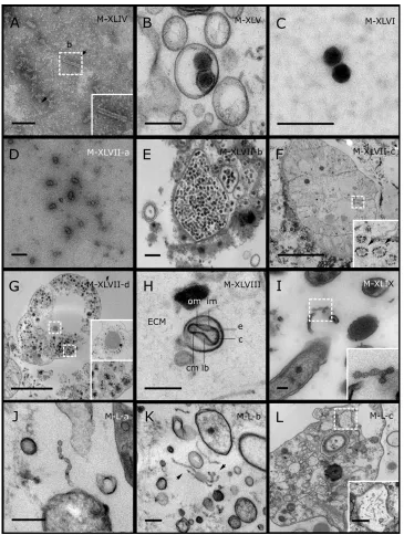 Figure 5Representative morphotypes of virus-like particles associated with GBR and Red Seasponges