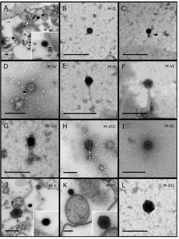 Figure 1Representative morphotypes of virus-like particles associated with GBR and Red Seasponges
