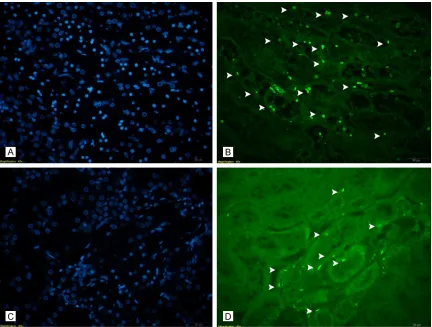 Figure 3. Apoptotic cell labelling staining with TUNEL (A) (IR group, DAPI), (B) (IR group, TUNEL): quite high number of apoptotic cells were seen (white arrow heads)