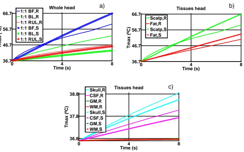 Figure 6.2. TmaxBF, BL and RUL for whole head; each tissue layer for BF electrode configuration (b) scalp and fat, (c)  (ºC) as a function of time for realistic (R) and spherical (S) models, isotropic cases (a) skull, CSF, GM, WM
