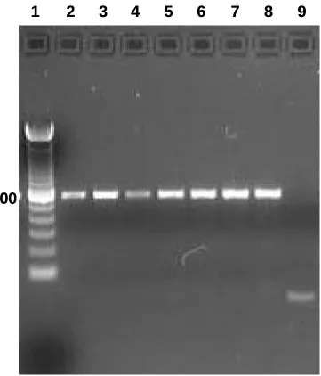 Figure 4. Example of an ethidium bromide-stained agarose gel of Smad3 amplification products from hCG-treated follicles  
