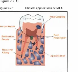 Figure 2.7.1 