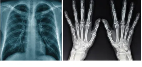 Fig 3. Fluoroscopy Images 