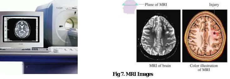 Fig 6. PET Images  