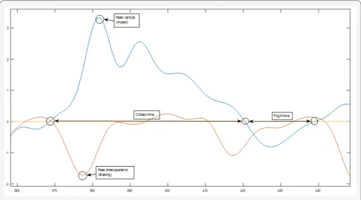 Figure 1: Typical acceleration wave form displaying estimation of contact time and flight time calculated in vertical acceleration, and peak vertical (impact) acceleration, and peak anteroposterior (braking) acceleration points