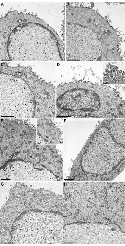 FIG 6 Ultrastructural analysis. Cell lines RK13-UL34 (A), RK13–G77A (B),RK13–L116A (C), RK13–P132A (D), RK13–L167A (E), RK13–N75A (F),RK13–N103A (G), and RK13–L166/167A (H) were infected with PrV-at an MOI of 1 and processed for electron microscopy at 16 h after infection.Bars, 2�UL34 �m and 500 nm (insets).