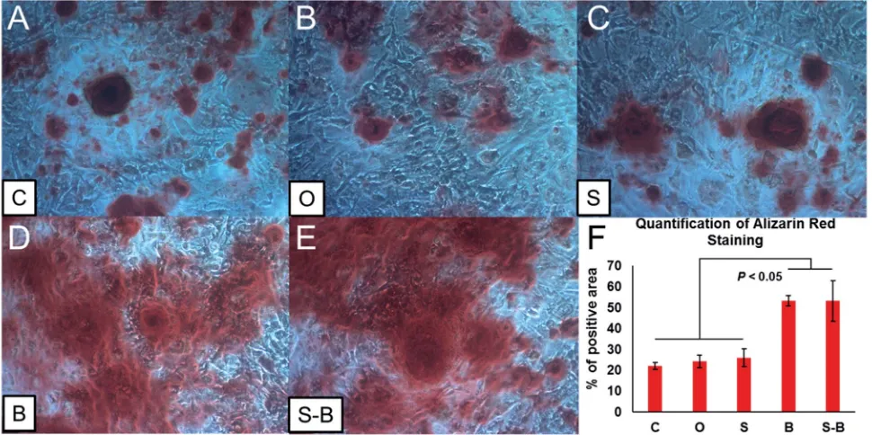 Fig. 8Alizarin Red staining of BMSCs (A–E) with diﬀerent treatment group sunder osteogenic induction for 14 days